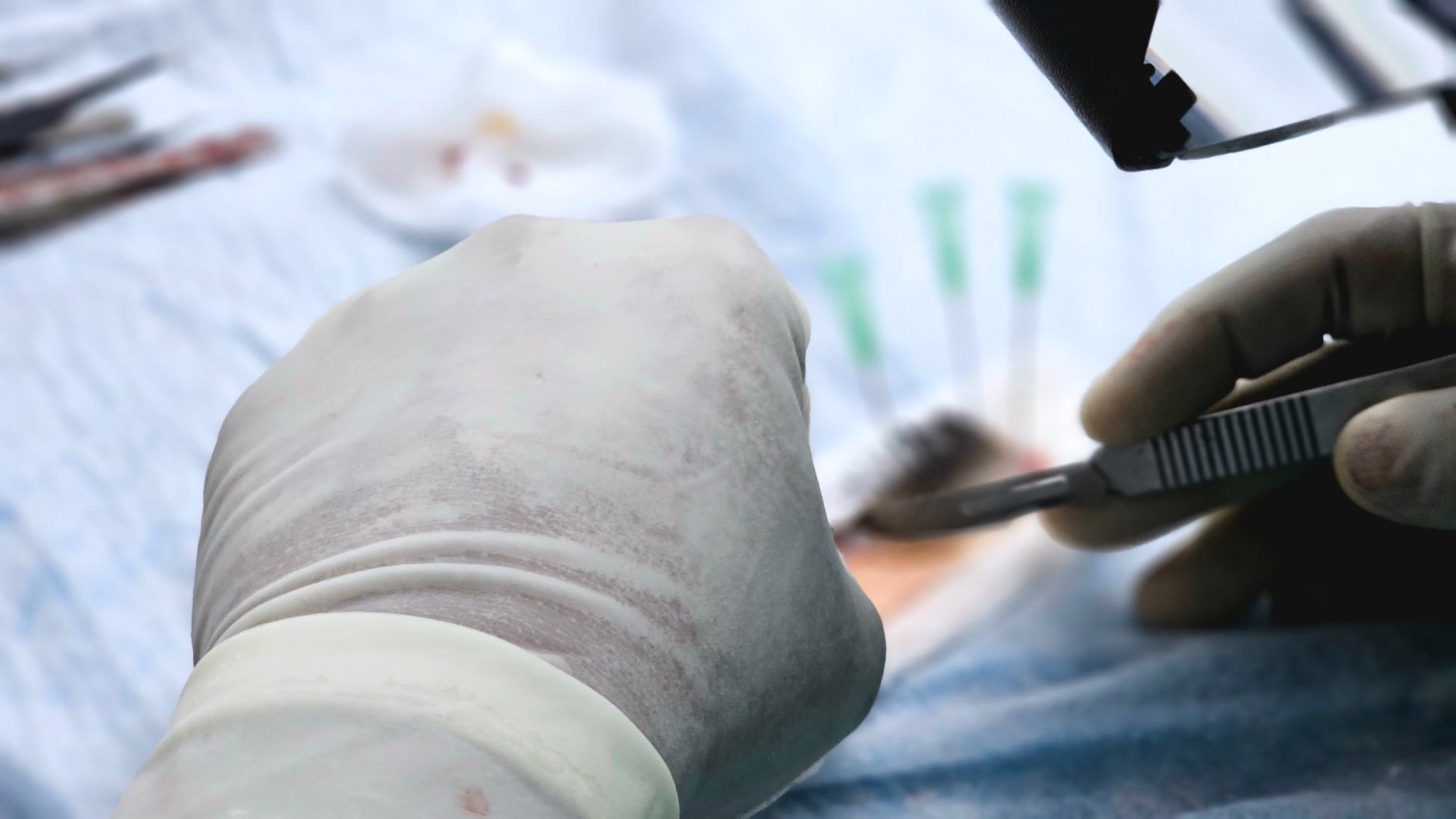 total cost plastic surgery korea hidden fees — editorial hero (Seoul Medical Insider)