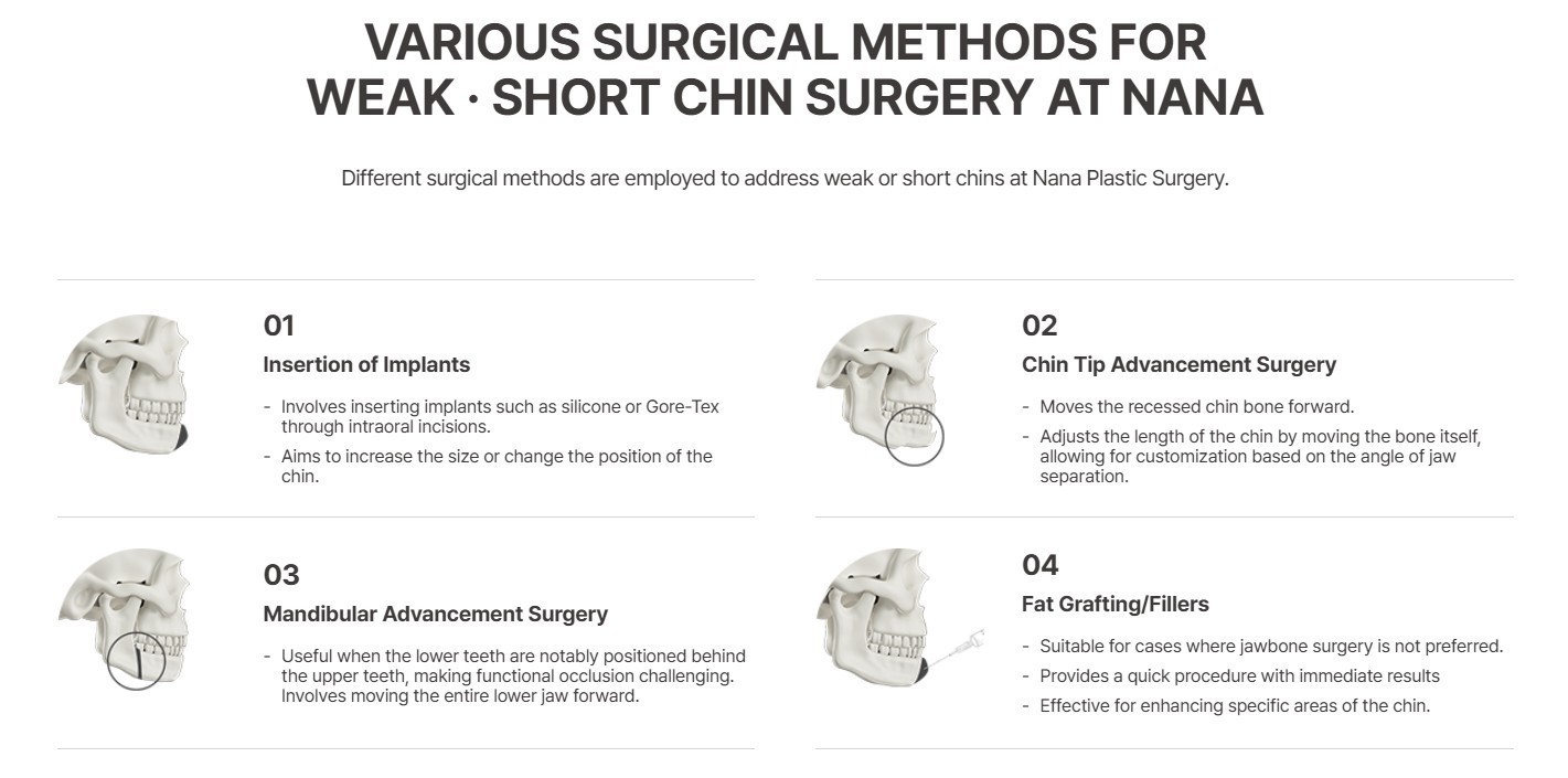 Skull diagrams illustrating four surgical methods for a weak or short chin: implants, chin tip advancement, mandibular advancement, and fat grafting.
