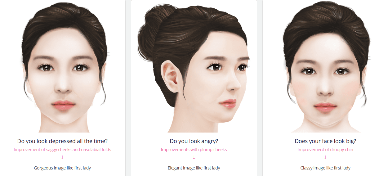 Three illustrated faces showing improvement of saggy cheeks, restored cheek volume, and reduced facial heaviness after facial lifting.