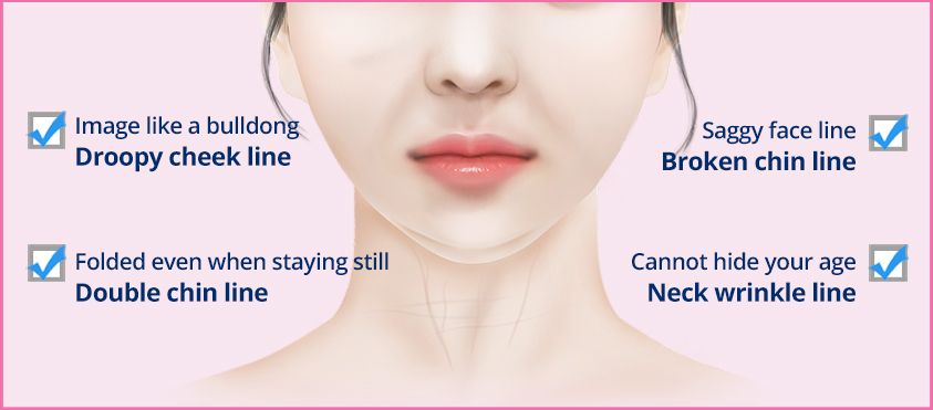 Illustration of a lower face with labeled aging signs: droopy cheeks, double chin, sagging jawline, and neck wrinkles.