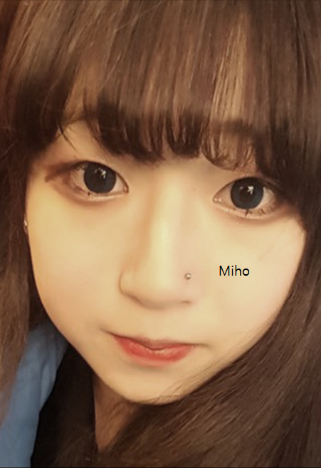 Miho K-Eyes & Rhinoplasty — before