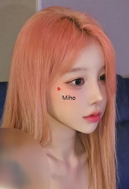 Miho K-Eyes & Rhinoplasty — after