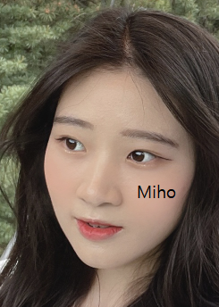 Miho K-Eyes & Rhinoplasty — before
