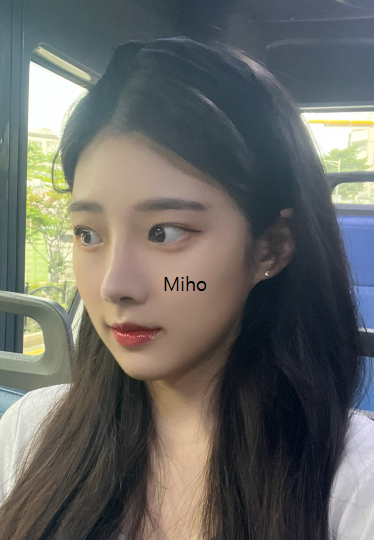 Miho K-Eyes & Rhinoplasty — after
