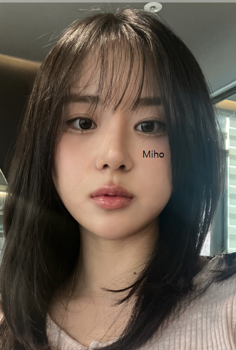 Miho K-Eyes & Rhinoplasty — after