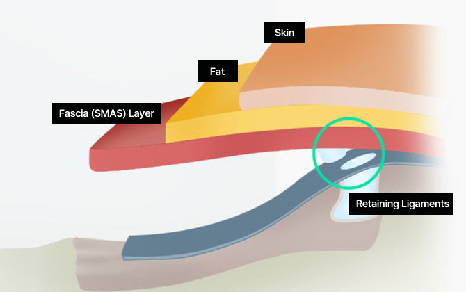 Why is the Release of Retaining Ligaments Necessary?