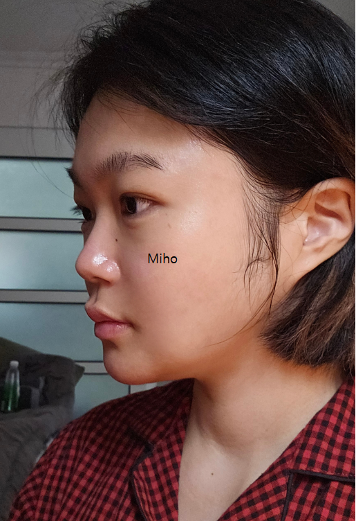 Before